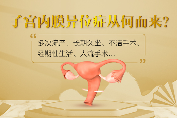 子宫内膜异位症